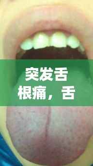 突发舌根痛,舌根突然很疼